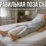 Женщина лежит на спине с плотным валиком между ног после эндопротезирования ТБС. Правильная поза сна. Фотореалистичное изображение.
